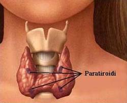 paratiroid